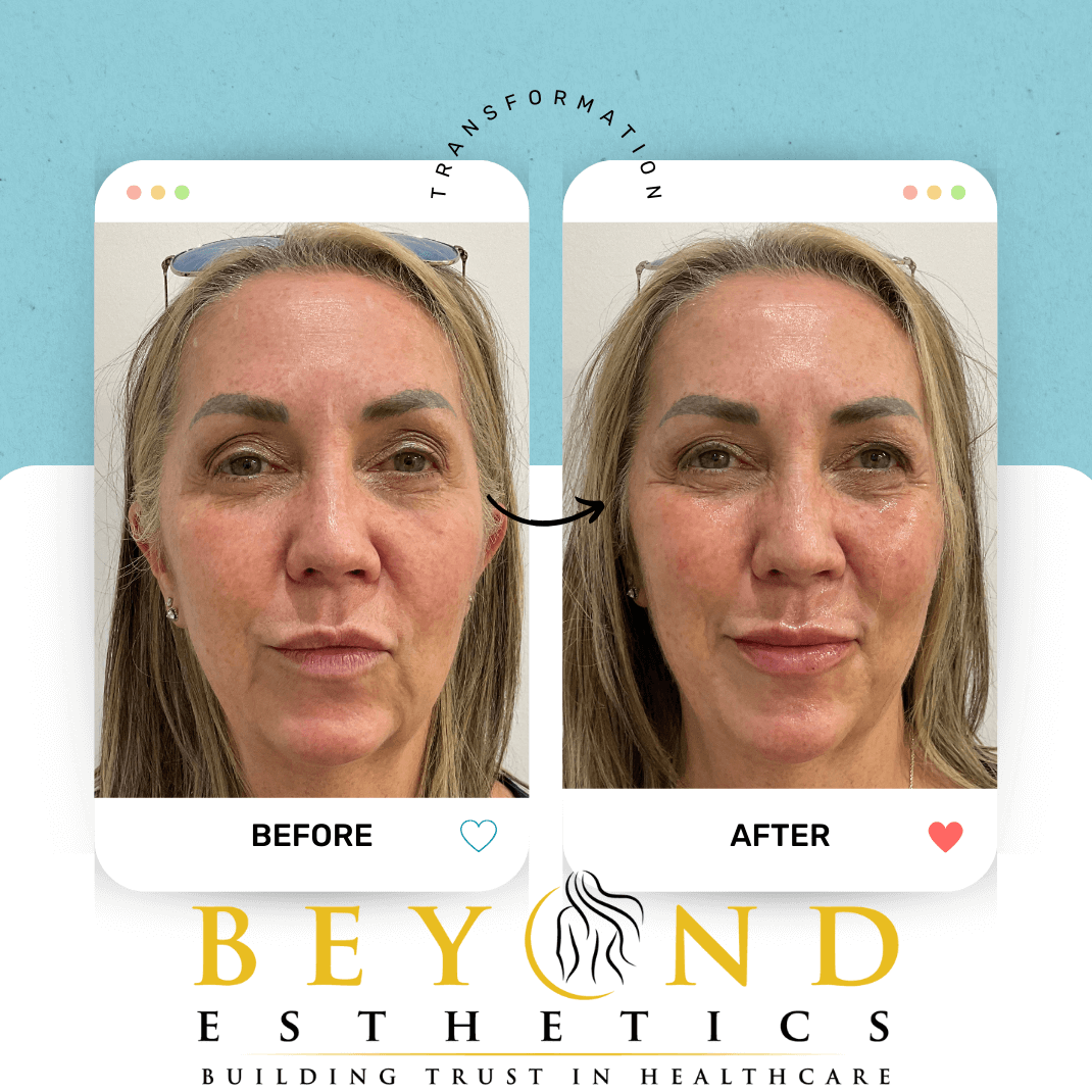 Full face facial rebalancing l